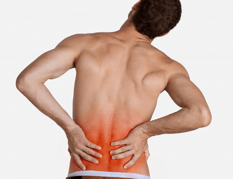Juosmens osteochondrozė