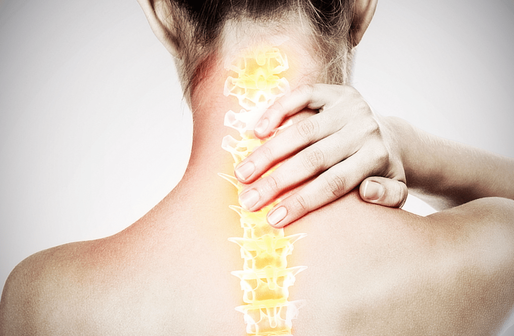 stuburo osteochondrozė